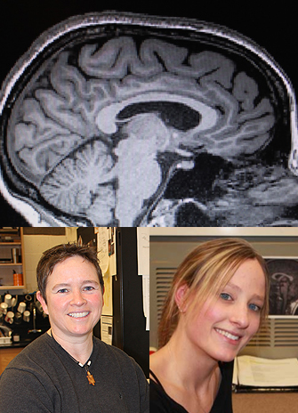 Clockwise from top, an image of a brain Kara Hawkins and Lauren Sergio