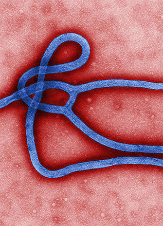 Ebola virus virion