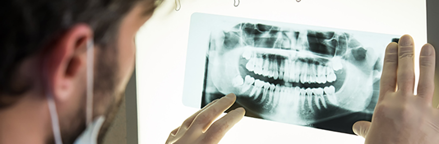 Dentist examining an x-ray of teeth